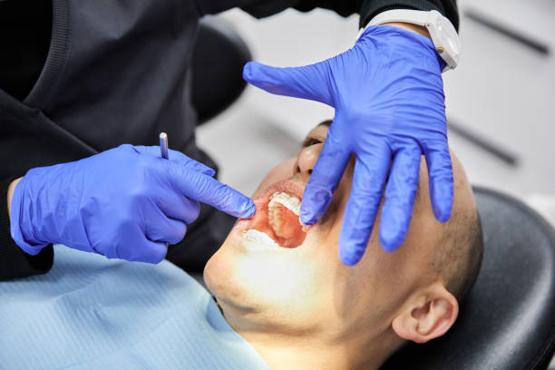 Best Emergency Wisdom Teeth Removal in Provo, UT